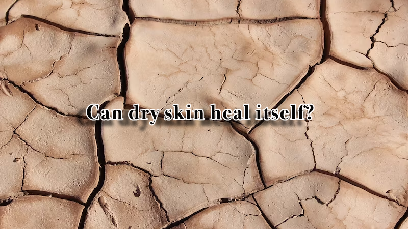 Can dry skin heal itself?