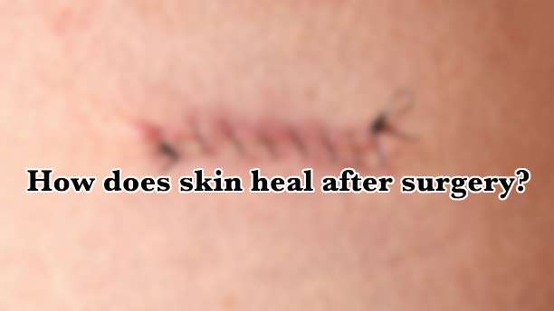 How does skin heal after surgery?