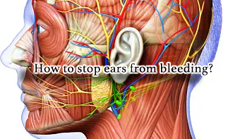How to stop ears from bleeding?