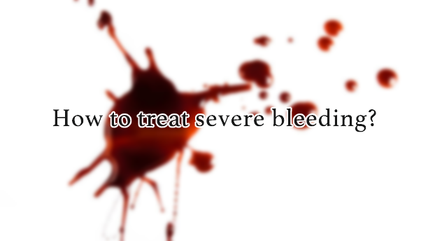 How to treat severe bleeding?