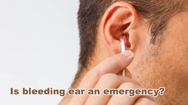 Is bleeding ear an emergency?
