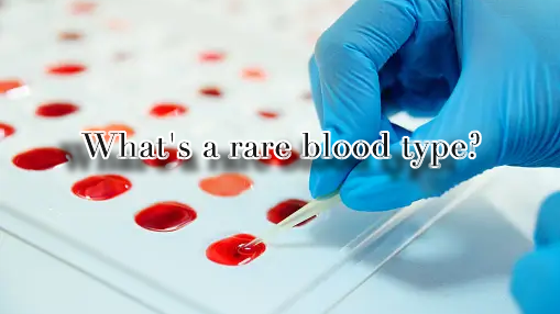 What's a rare blood type?